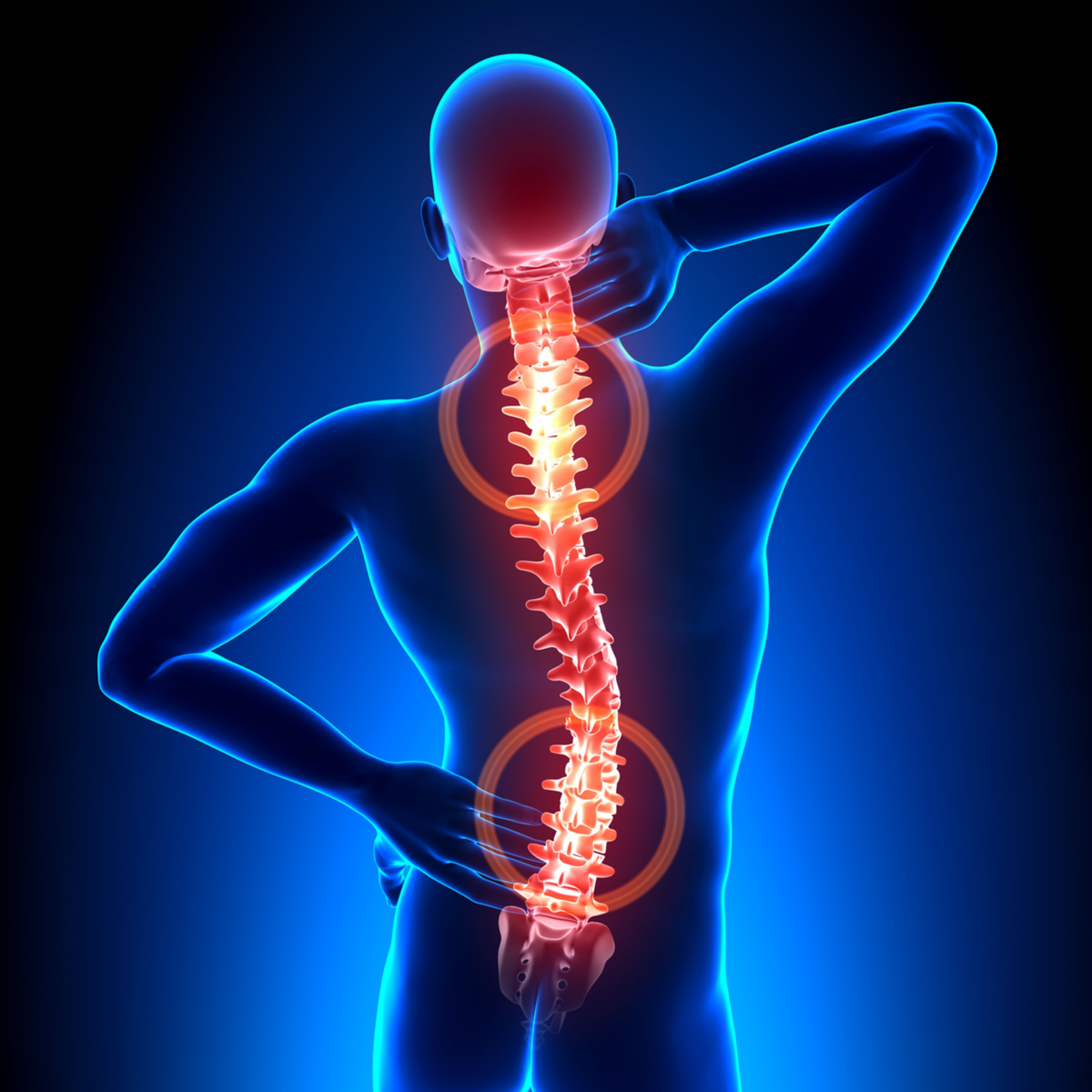 spine-disorders
