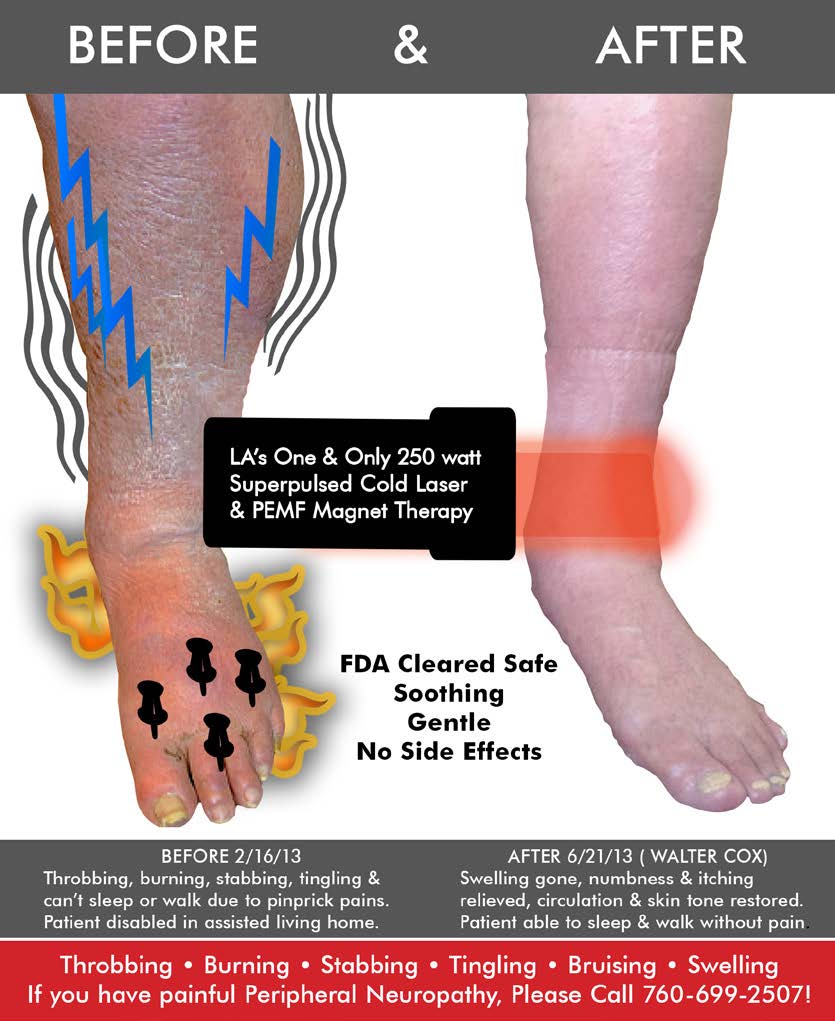 Relieve the Pain & Numbness in Your Feet, Knees & Legs  